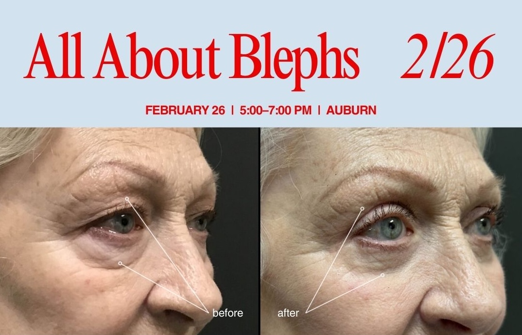 Eye-Lid Surgery Educational Event -Blepharoplasty